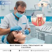 Best Root Canal Treatment in Lalitpur